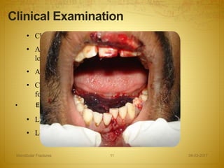 • Change in occlusion
• Anesthesia, Paresthesia or Dysesthesia of
lower lip
• Abnormal mandibular movements
• Change in facial contour and mandibular arch
form
• Extensive edema,tenderness.
• Laceration, Hematoma and Ecchymosis
• Loose teeth and crepitation on palpation
Clinical Examination
08-03-2017Mandibular Fractures 11
 
