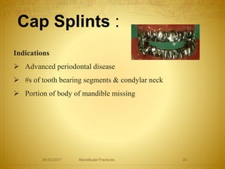 Cap Splints :
Indications
 Advanced periodontal disease
 #s of tooth bearing segments & condylar neck
 Portion of body of mandible missing
08-03-2017 Mandibular Fractures 24
 