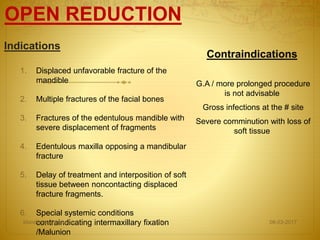 Indications
1. Displaced unfavorable fracture of the
mandible
2. Multiple fractures of the facial bones
3. Fractures of the edentulous mandible with
severe displacement of fragments
4. Edentulous maxilla opposing a mandibular
fracture
5. Delay of treatment and interposition of soft
tissue between noncontacting displaced
fracture fragments.
6. Special systemic conditions
contraindicating intermaxillary fixation
/Malunion
Contraindications
G.A / more prolonged procedure
is not advisable
Gross infections at the # site
Severe comminution with loss of
soft tissue
08-03-2017Mandibular Fractures 28
OPEN REDUCTION
 