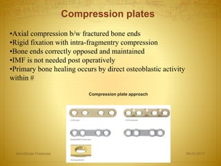 Compression plates
•Axial compression b/w fractured bone ends
•Rigid fixation with intra-fragmentry compression
•Bone ends correctly opposed and maintained
•IMF is not needed post operatively
•Primary bone healing occurs by direct osteoblastic activity
within #
Compression plate approach
08-03-2017Mandibular Fractures 33
 