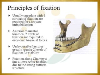 08-03-2017Mandibular Fractures 36
 