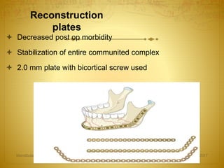 Reconstruction
plates
08-03-2017Mandibular Fractures 45
 Decreased post op morbidity
 Stabilization of entire communited complex
 2.0 mm plate with bicortical screw used
 