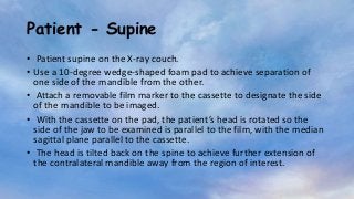Patient - Supine
• Patient supine on the X-ray couch.
• Use a 10-degree wedge-shaped foam pad to achieve separation of
one side of the mandible from the other.
• Attach a removable film marker to the cassette to designate the side
of the mandible to be imaged.
• With the cassette on the pad, the patient’s head is rotated so the
side of the jaw to be examined is parallel to the film, with the median
sagittal plane parallel to the cassette.
• The head is tilted back on the spine to achieve further extension of
the contralateral mandible away from the region of interest.
 