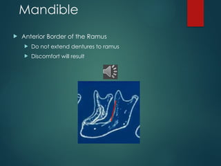 Mandible & Mandibular Denture anatomy1.pptx