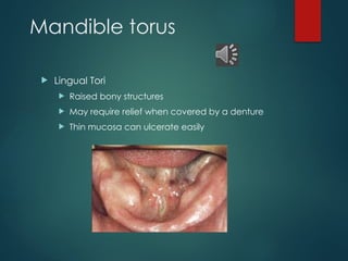 Mandible & Mandibular Denture anatomy1.pptx