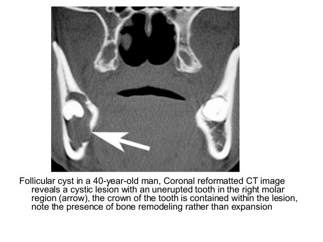 Diagnostic Imaging of Mandible & Maxilla