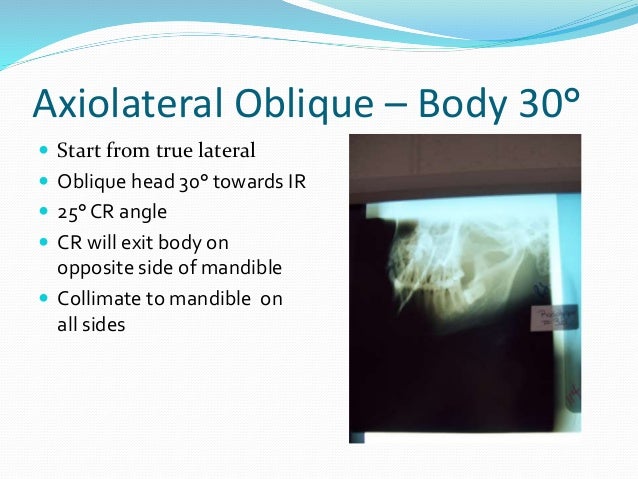 Mandible and maxilla oblique radiography