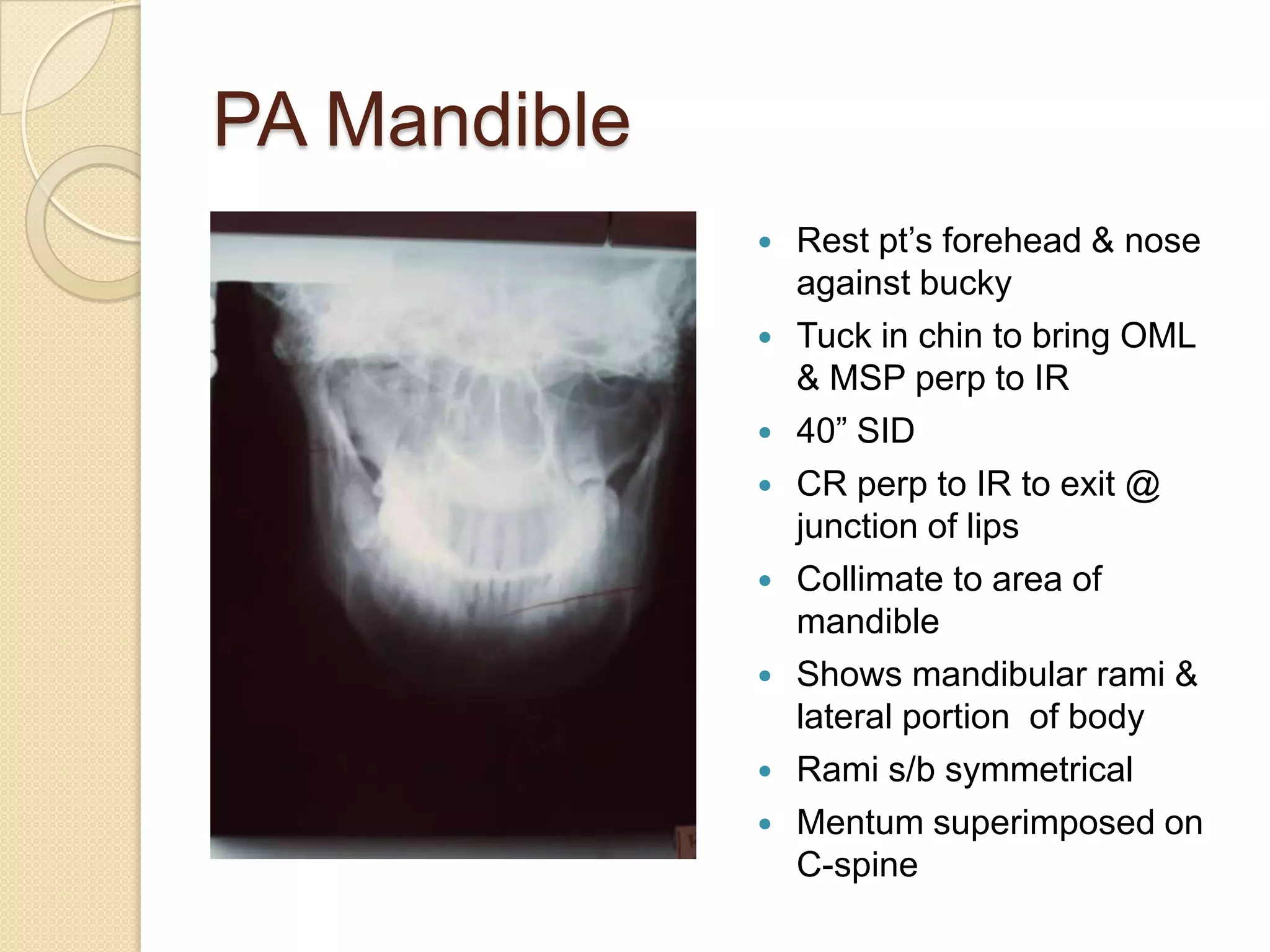 Mandible, T M J