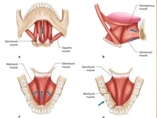 27-04-2016Mandibular Fractures 10
 