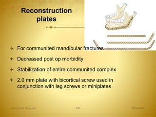 Reconstruction
plates
27-04-2016Mandibular Fractures 100
 For communited mandibular fractures
 Decreased post op morbidity
 Stabilization of entire communited complex
 2.0 mm plate with bicortical screw used in
conjunction with lag screws or miniplates
 