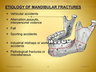ETIOLOGY OF MANDIBULAR FRACTURES
 Vehicular accidents
 Altercation,assaults,
interpersonel violence
 Fall
 Sporting accidents
 Industrial mishaps or work
accidents
 Pathological fractures or
miscellaneous
27-04-2016Mandibular Fractures 14
 