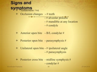 Signs and
symptoms Tenderness +ve
 Occlusion changes - # teeth
- # alveolar process
- # mandible at any location
- # condyle
 Anterior open bite - B/L condylar #
 Posterior open bite - parasymphysis #
 Unilateral open bite - # ipsilateral angle
- # parasymphysis
 Posterior cross bite - midline symphysis #
- condylar #
27-04-2016Mandibular Fractures 38
 