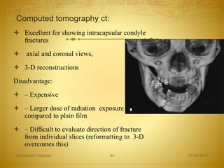 Computed tomography ct:
 Excellent for showing intracapsular condyle
fractures
 axial and coronal views,
 3-D reconstructions
Disadvantage:
 – Expensive
 – Larger dose of radiation exposure
compared to plain film
 – Difficult to evaluate direction of fracture
from individual slices (reformatting to 3-D
overcomes this)
27-04-2016Mandibular Fractures 44
 