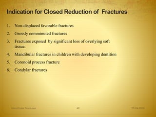 1. Non-displaced favorable fractures
2. Grossly comminuted fractures
3. Fractures exposed by significant loss of overlying soft
tissue.
4. Mandibular fractures in children with developing dentition
5. Coronoid process fracture
6. Condylar fractures
Indication for Closed Reduction of Fractures
27-04-2016Mandibular Fractures 49
 
