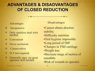 ADVANTAGES & DISADVANTAGES
OF CLOSED REDUCTION
Advantages
 Inexpensive
 Only stainless steel wire
needed
 Convenient
 Gives occlusion
 Conservative
 O.T not required
 Generally easy ,no great
operator skill needed
Disadvantages
27-04-2016Mandibular Fractures 50
•Cannot obtain absolute
stability
•Difficulty nutrition
•Oral hygiene impossible
•Long period of IMF
•Changes in TMJ cartilage
•Weight loss
•Decrease range of motion of
mandible
•Risk of wounds to operator
 