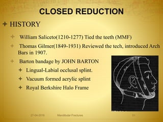 CLOSED REDUCTION
 HISTORY
 William Saliceto(1210-1277) Tied the teeth (MMF)
 Thomas Gilmer(1849-1931) Reviewed the tech, introduced Arch
Bars in 1907.
 Barton bandage by JOHN BARTON
 Lingual-Labial occlusal splint.
 Vacuum formed acrylic splint
 Royal Berkshire Halo Frame
27-04-2016 Mandibular Fractures 51
 