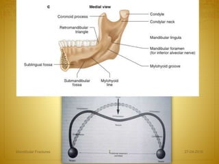 27-04-2016Mandibular Fractures 7
 