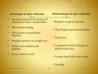 Advantages of open reduction.
 Accurate reduction & fixation of
fractures by direct visualization.
 Better bone healing.
 Early return to normal jaw
function.
 Normal nutrition, no weight loss.
 Patient can maintain oral
hygiene.
 Early return to work.
27-04-2016Mandibular Fractures 74
Disadvantages of open reduction.
• Requires surgical exposure.
• May Require general anesthesia.
• Expensive.
• Compared to IMF technique is
difficult and risky
• Foreign body left in the tissues.
• Scarring.
 