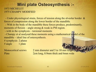 Mini plate Osteosynthesis :-
1973 MICHELET
1975 CHAMPY MODIFIED
- Under physiological strain, forces of tension along the alveolar border &
forces of compression along the lower border of the mandible.
- With in the body of the mandible these forces produce, predominantly,
moments of flexion – angle strong & weak in PM region.
- with in the symphysis – torsional moments
- Champy et al analysed these moments using a mathematical model of the
mandible – ideal line of osteosynthesis.
# symphysis 2 plates
# angle 1 plate
Monocortical screws 2 mm diameter and 5 to 10 mm length
Plate 2cm long, 0.9mm thick and 6mm wide
27-04-2016Mandibular Fractures 85
 