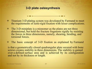 3-D plate ostesynthesis
 Titanium 3-D plating system was developed by Farmand to meet
the requirements of semi-rigid fixation with lesser complications.
 The 3-D miniplate is a misnomer as the plates are not three
dimensional, but hold the fracture fragments rigidly by resisting
the forces in three dimensions, namely, shearing, bending, and
torsional forces.
 The basic concept of 3-D fixation as explained by Farmand
is that a geometrically closed quadrangular plate secured with bone
screws creates stability in three dimensions. The stability is gained
over a defined surface area and is achieved by its configuration
and not by its thickness or length.
27-04-2016Mandibular Fractures 91
 