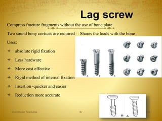 Lag screw
Compress fracture fragments without the use of bone plate
Two sound bony cortices are required -- Shares the loads with the bone
Uses:
 absolute rigid fixation
 Less hardware
 More cost effective
 Rigid method of internal fixation
 Insertion -quicker and easier
 Reduction more accurate
27-04-2016Mandibular Fractures 97
 