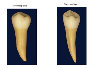 Three cusp type
Two cusp type
 