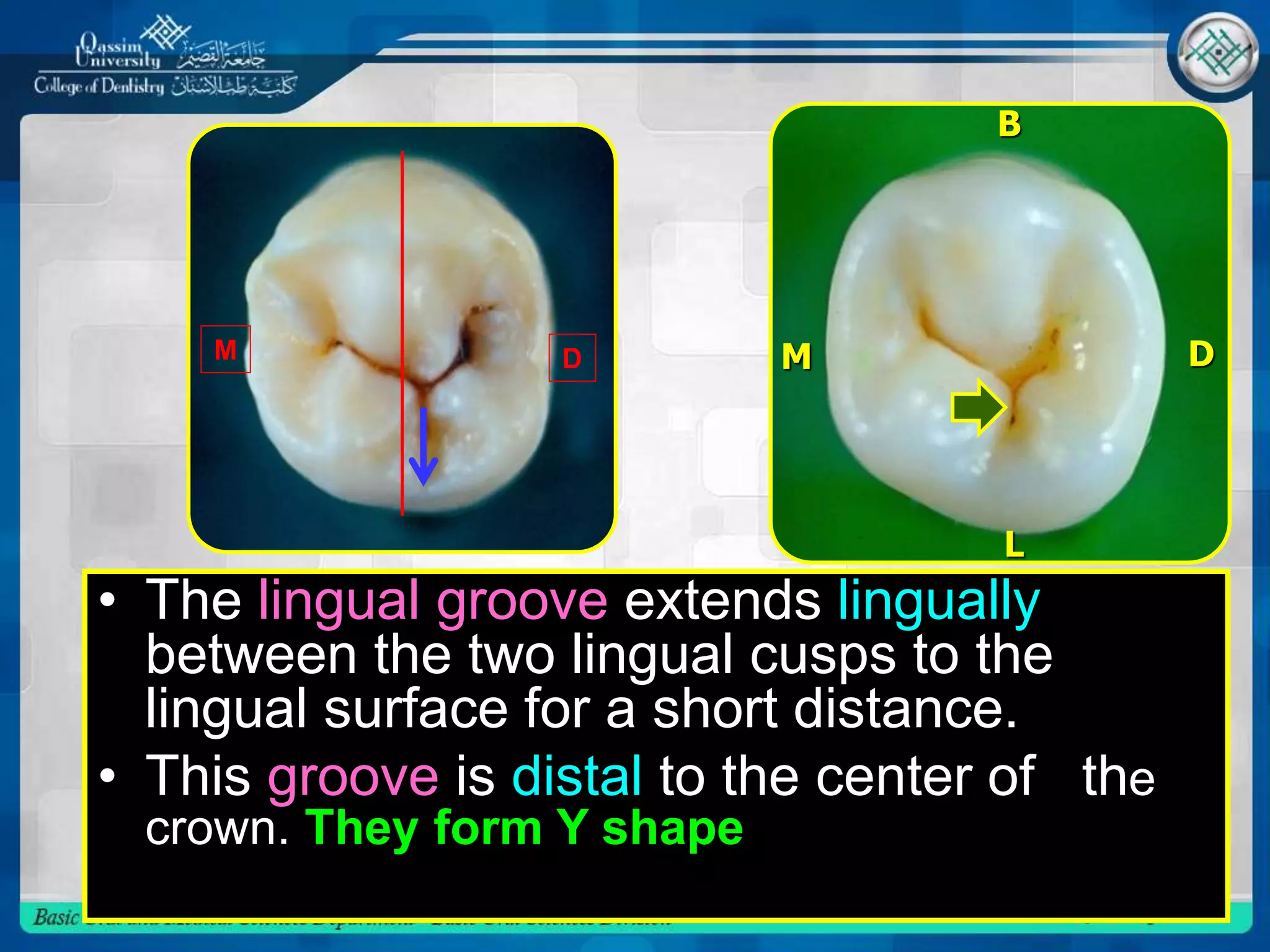 • The lingual groove extends lingually
between the two lingual cusps to the
lingual surface for a short distance.
• This groove is distal to the center of the
crown. They form Y shape
L
B
DMM D
 