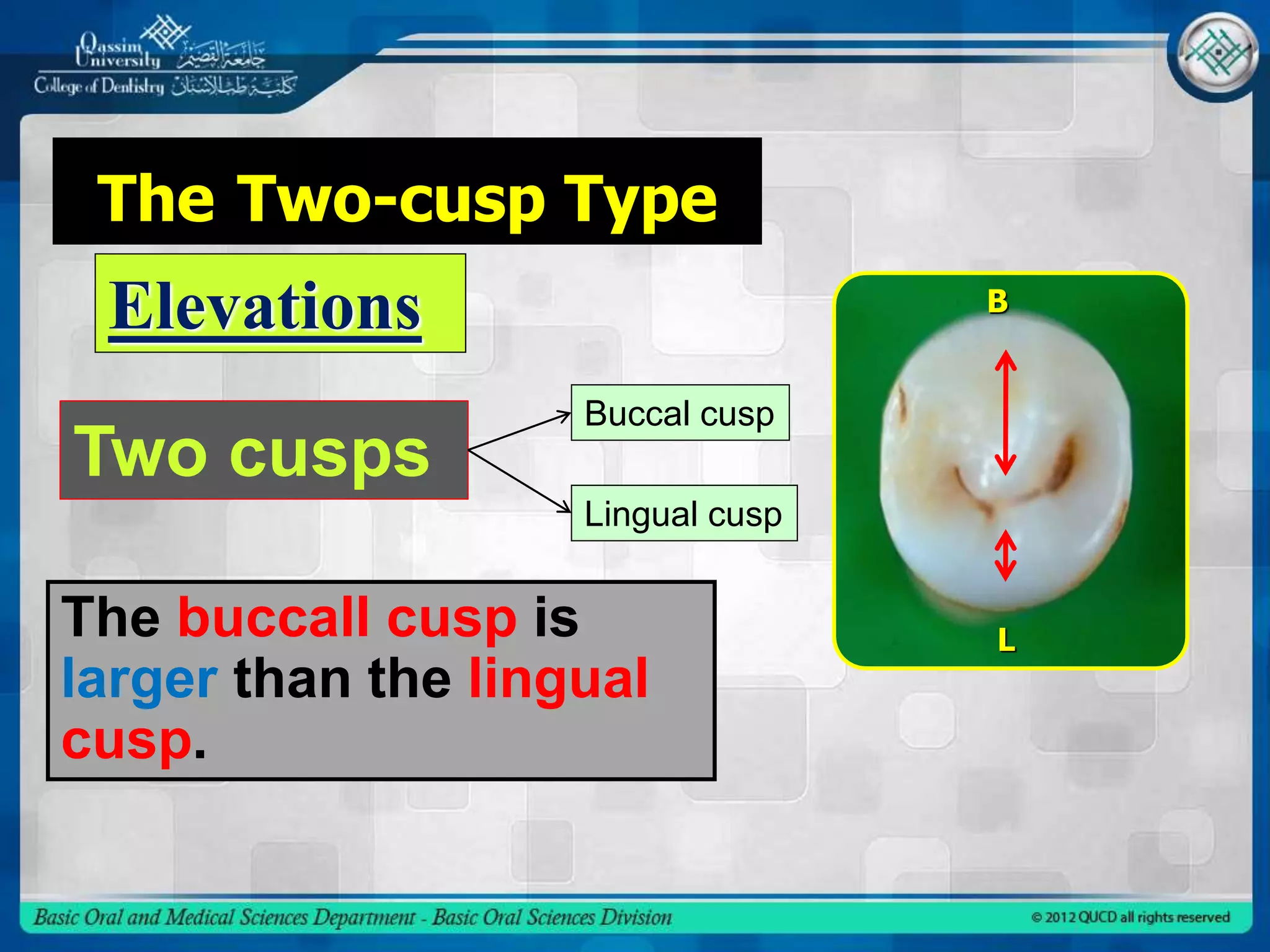 The Two-cusp Type
Elevations
The buccall cusp is
larger than the lingual
cusp.
B
L
Two cusps
Buccal cusp
Lingual cusp
 