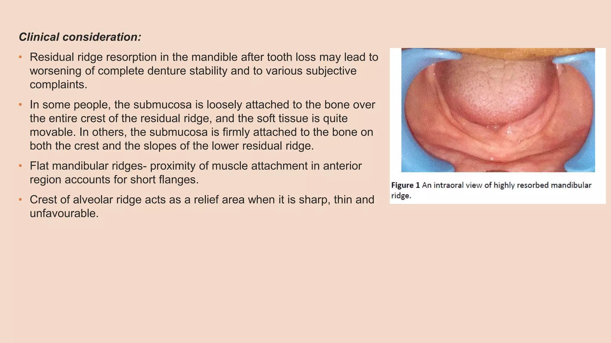 Inner Mandibular Ridge Mandibular anatomical landmarks | PPTX