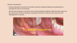 Clinical consideration:
• During impression procedure the cheek should be reflected laterally and posteriorly to
simulate the frenum movements.
• During final impression procedure and in final prosthesis sufficient relief should be given for
the movement of frenum because overriding of function of frenum will cause pain and
dislodgement of denture.
 