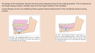 The flange of the mandibular denture should provide adequate space for the sublingual gland. This is achieved by
the flange sloping inwards, medially away from the lingual surface of the mandible.
Lingual flanges are the only stabilizing feature against lateral displacement of the mandibular denture during
function.
 