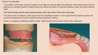Clinical Consideration:
• The position of the pads remains constant, even after the natural teeth are extracted. these facts ensure that the
pads are an excellent guide for determining and setting the plane of occlusion between upper and lower denture
teeth.
• The denture base should extend approximately half to two thirds of the retro molar pad.
• The pads serve as bilateral, distal support for the mandibular denture. The muscle limit the denture extent and
prevent the placement of extra pressure during impression making.
• Helps in arranging mandibular posterior teeth. Teeth should not be placed on the retro molar pad.
 