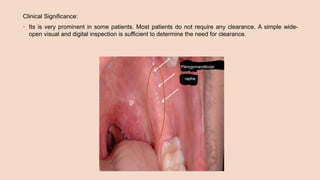 Clinical Significance:
• Its is very prominent in some patients. Most patients do not require any clearance. A simple wide-
open visual and digital inspection is sufficient to determine the need for clearance.
 