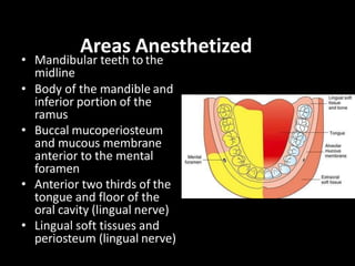 Areas Anesthetized
• Mandibular teeth to the
midline
• Body of the mandible and
inferior portion of the
ramus
• Buccal muc...