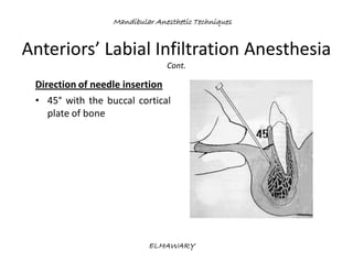 Mandibular anesthetic techniques | PDF