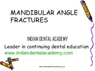 MANDIBULAR ANGLE
FRACTURES
INDIAN DENTAL ACADEMY
Leader in continuing dental education
www.indiandentalacademy.com
www.indiandentalacademy.com

 