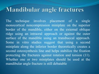 The technique involves placement of a single
monocortical noncompression miniplate on the superior
border of the mandible, either on the external oblique
ridge using an intraoral approach or against the outer
surface of the mandible using an transbuccal approach.
Some in vitro studies suggest that using a second
miniplate along the inferior border theoretically creates a
second osteosynthesis line and helps stabilize the fixation
protecting the fractures against rotation and torsion (11).
Whether one or two miniplates should be used at the
mandibular angle fracture is still debatable
 
