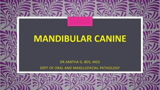 MANDIBULAR CANINE
DR AMITHA G, BDS, MDS
DEPT OF ORAL AND MAXILLOFACIAL PATHOLOGY
 