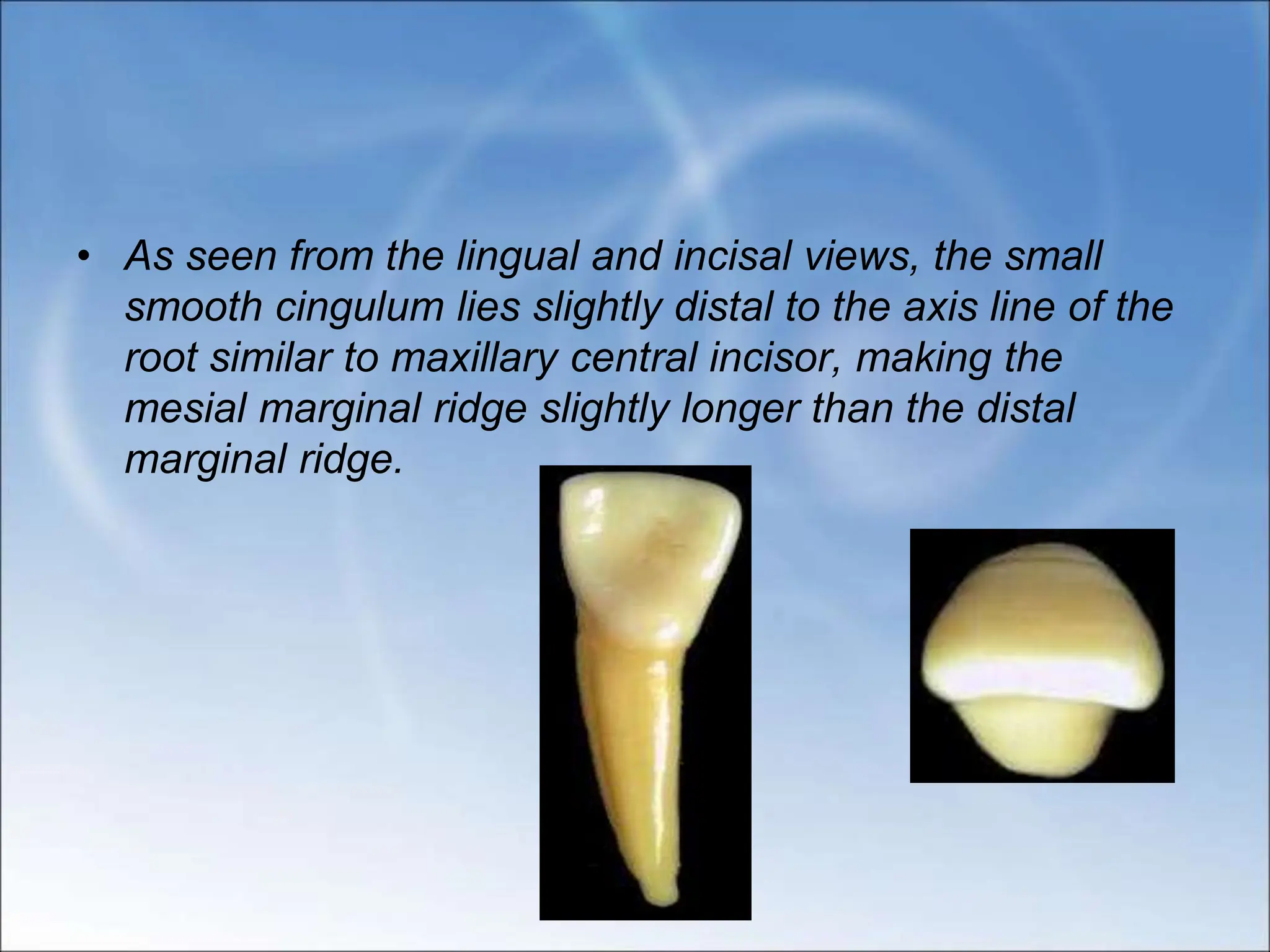 MANDIBULAR CENTRAL AND LATERAL INCISOR.ppt