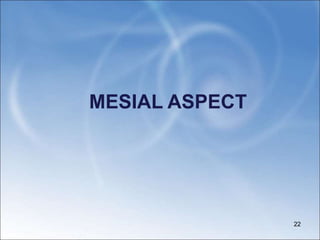 MESIAL ASPECT
22
 
