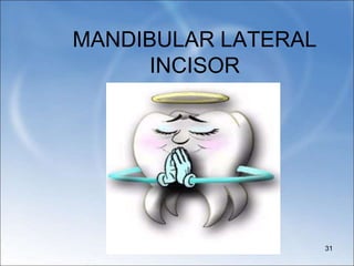 MANDIBULAR LATERAL
INCISOR
31
 