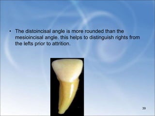 • The distoincisal angle is more rounded than the
mesioincisal angle. this helps to distinguish rights from
the lefts prior to attrition.
39
 
