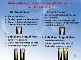 Lateral incisor
Distinguish features between mandibular central
and lateral incisor
Central incisor
 More symmetrical
 Smaller overall and shorter root
 Crown is 0.6mm shorter, root is
0.9 mm shorter in same mouth
 .
 Labial and lingual view-
o Same level contacts
o Crown not bent distally on root
o No distal side bulge on crown.
 Less symmetrical[labial, lingual,
incisal views]
o Crown larger overall[especially
mesiodistallyby 0.4mm]with longer
root [0.9mm longer]
 Labial and lingual view-
o Lower distal contact.
o Crown tipped distally on root.
o Distal side bulge on crown.
50
 