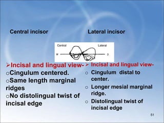 Central incisor Lateral incisor
 Incisal and lingual view-
o Cingulum distal to
center.
o Longer mesial marginal
ridge.
o Distolingual twist of
incisal edge
51
Incisal and lingual view-
oCingulum centered.
oSame length marginal
ridges
oNo distolingual twist of
incisal edge
 