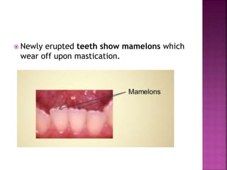  Newly erupted teeth show mamelons which
wear off upon mastication.
 