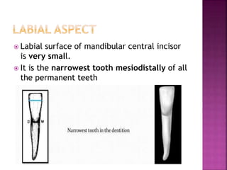  Labial surface of mandibular central incisor
is very small.
 It is the narrowest tooth mesiodistally of all
the permanent teeth
 