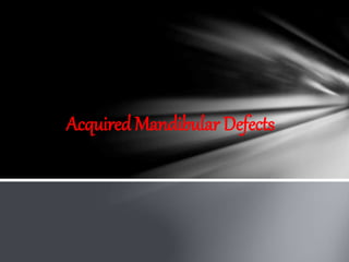 Acquired Mandibular Defects
 