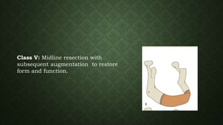 MANDIBULAR_DEFECTS( SEMI 4).pptx