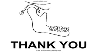 Mandibularfracture 131118111112-phpapp02