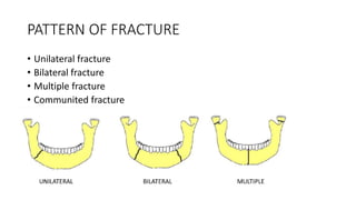 PATTERN OF FRACTURE
• Unilateral fracture
• Bilateral fracture
• Multiple fracture
• Communited fracture
 